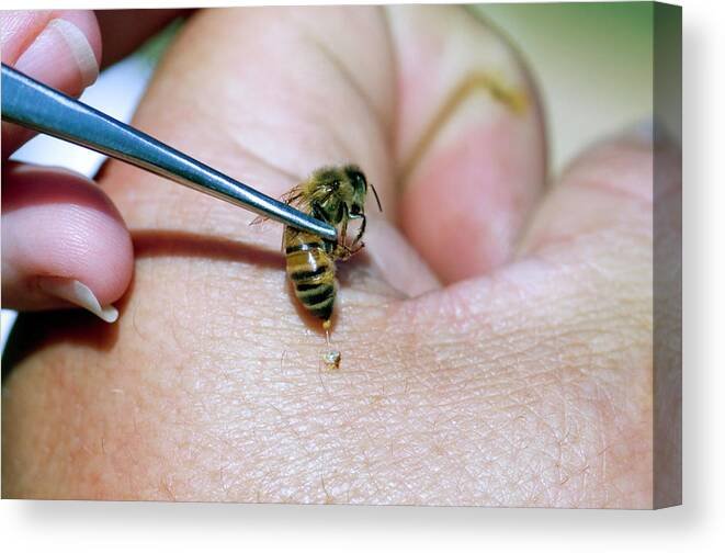 Apitherapy Bee Sting Bees Texas Honeybee Ag Exemption Program Fort Worth Ten Box Bees